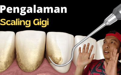 Pengalaman Pertama Aku Scaling Gigi. Sakit Ke?