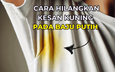 Cara Hilangkan Kesan Kuning Pada Baju Putih